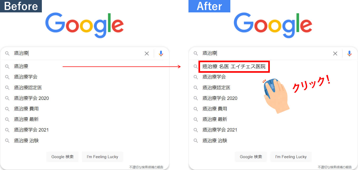 Before After