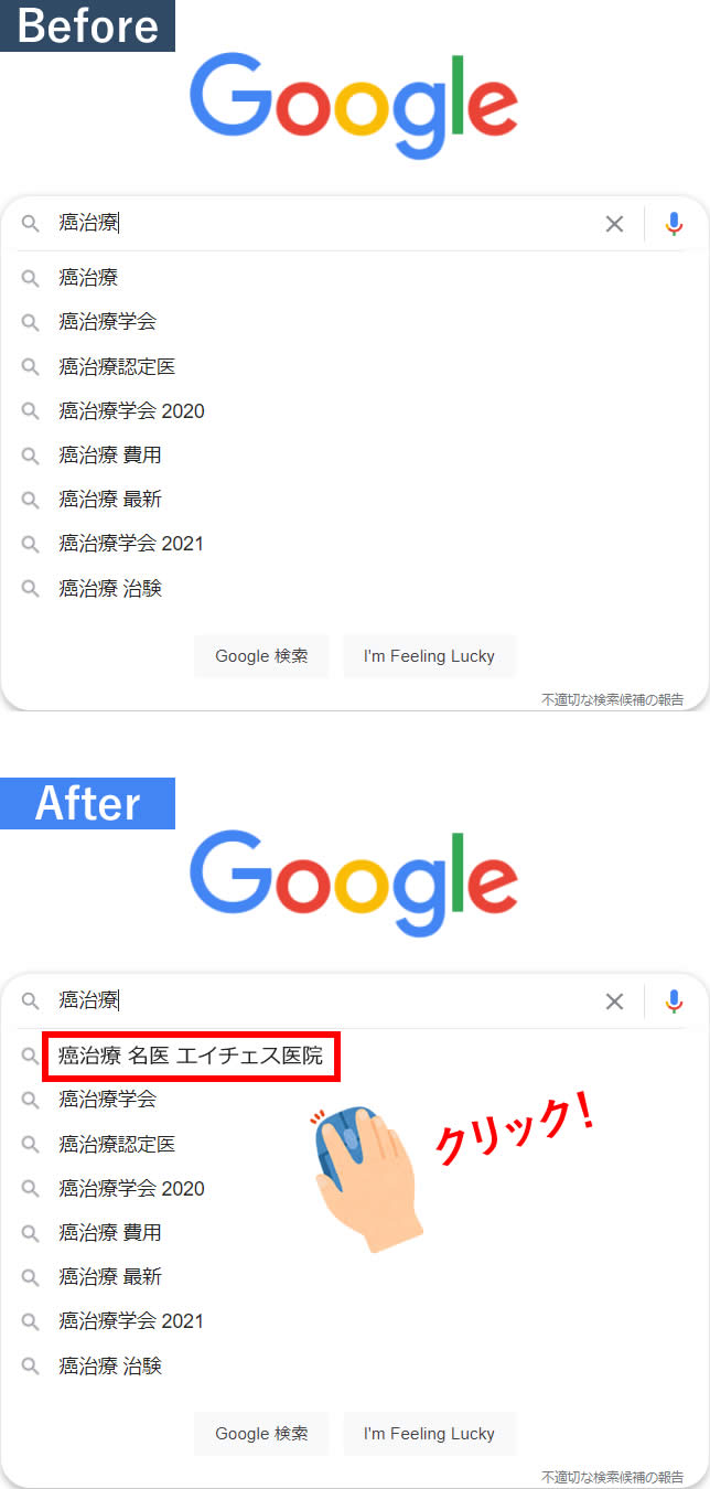 Before After